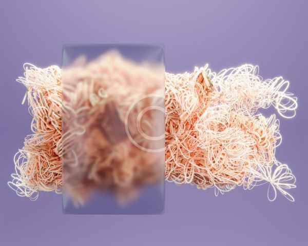 Tangled Threads